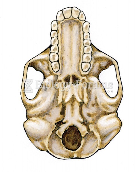 Underside of chimpanzee skull
