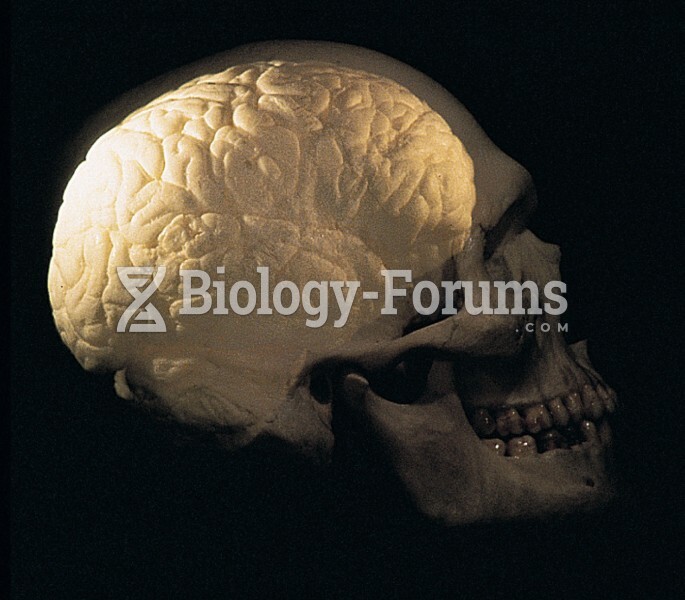 Human brain and skull