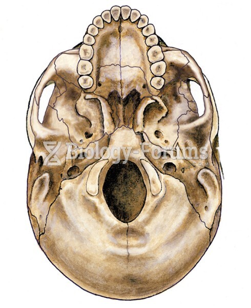 Underside of human skull
