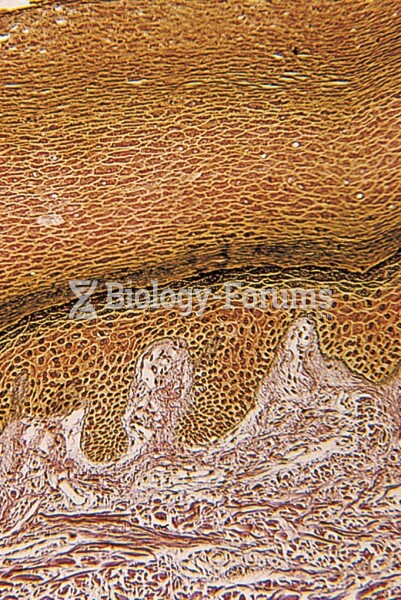 The photo is a cross-section of thickened human skin