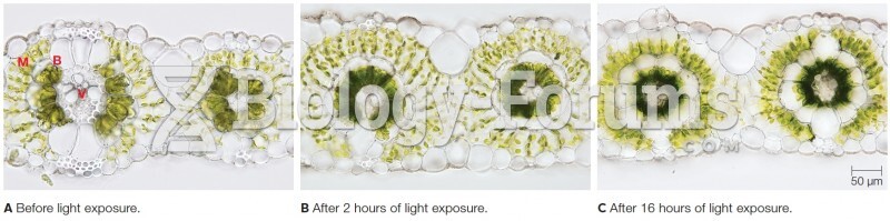 Movement of Chloroplasts in Response to Light