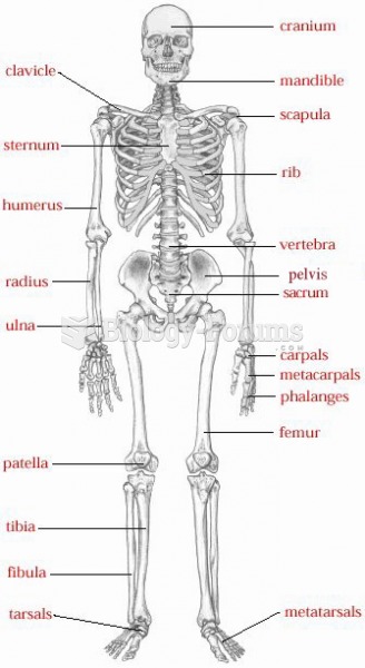 Skeleton Diagram