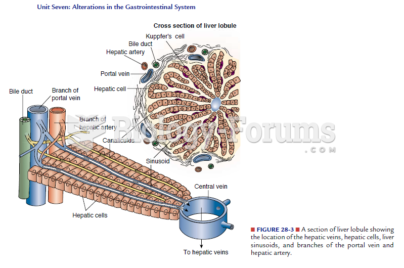 Liver lobule cross section