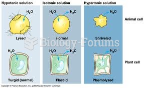 plant and animal cells when hypertonic and hypotonic