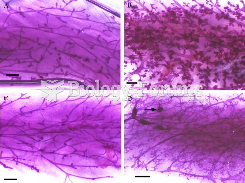 Abnormal Growth in Mice Mammary Tissue
