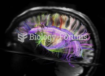 Diffusion spectrum MR image of human brain