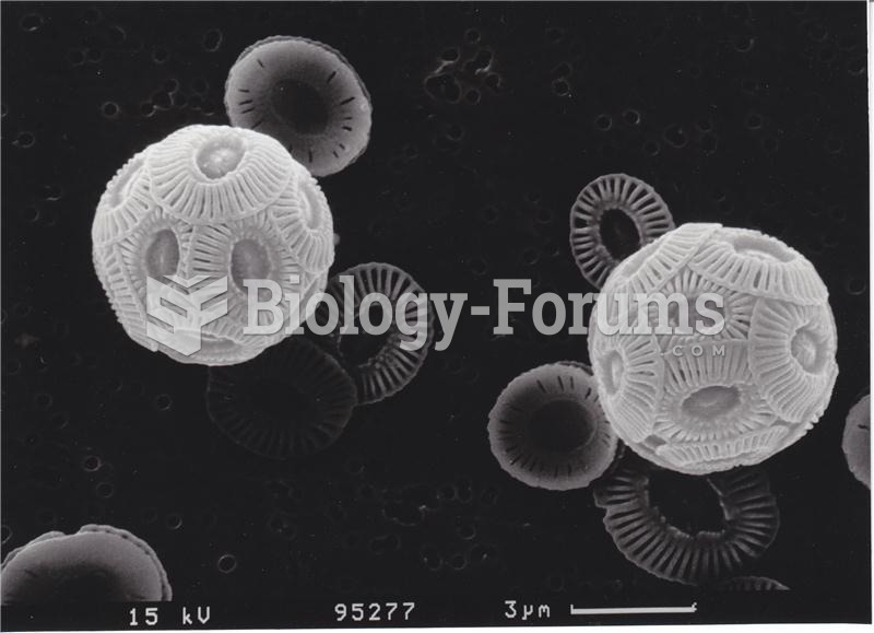 Emiliania huxleyi cells in an electro-microscopic picture.