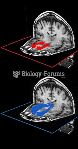 Brain scans showing the white-matter pathways involved in everyday learning: