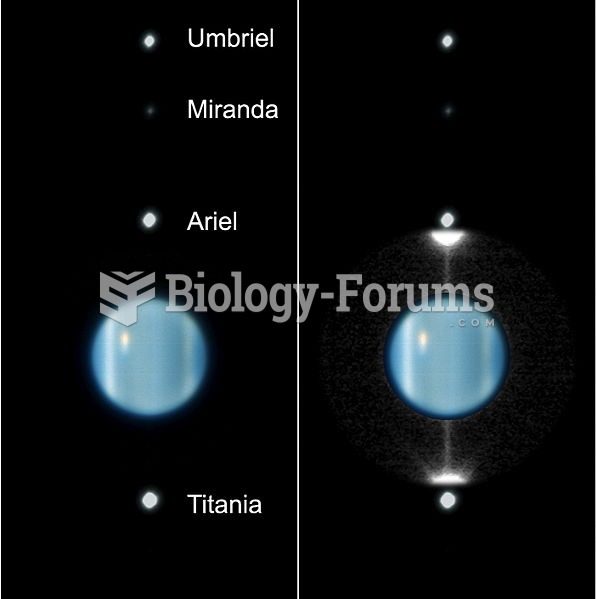 The Uranus System
