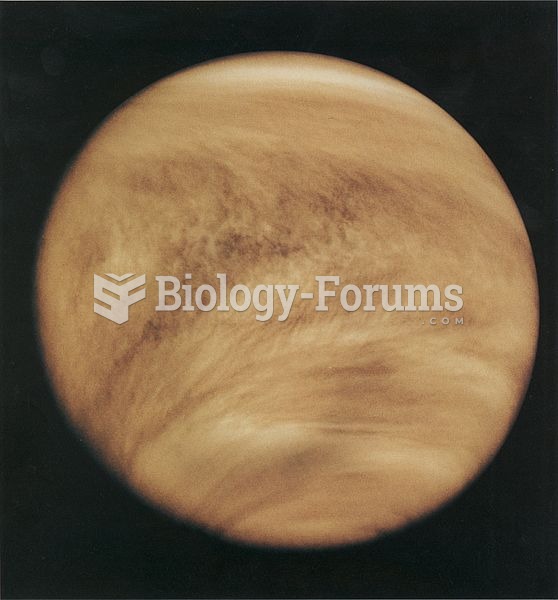 Atmosphere of Venus in UV, by Pioneer Venus Orbiter in 1979