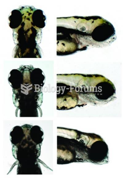 Here are images of live zebrafish that were studied for genetics and head size to give insight into 