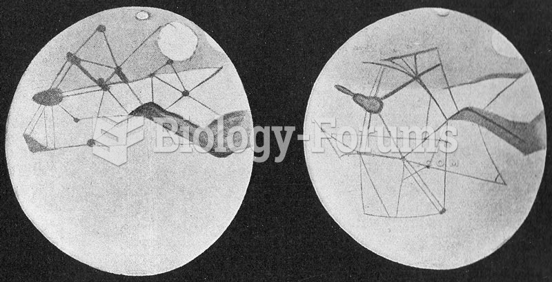 Mars sketched as observed by Lowell sometime before 1914. (South top)