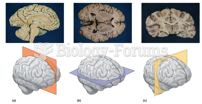 Sections of the Human Brain