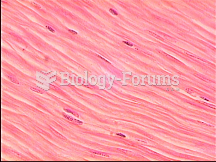 Smooth muscle under microscope