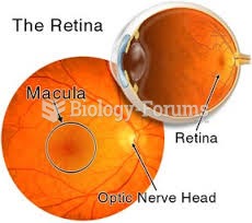 Retina eye