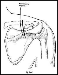 Suprascapular notch