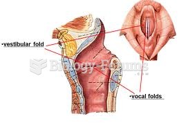 Vestibular fold