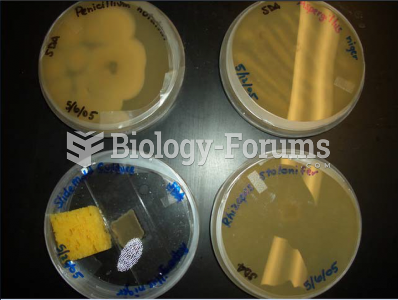 Different Fungi in Petri Dishes