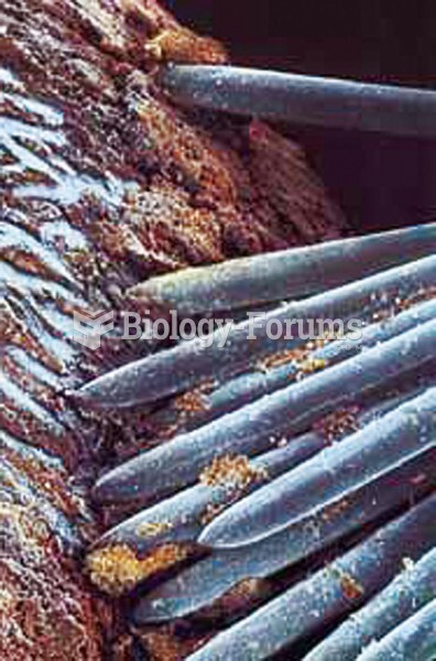 Micrograph of toothbrush bristles scrubbing plaque on a tooth surface. 