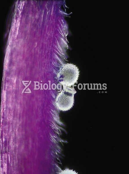 Pollen on stigmata - mallow (Malva neglecta)