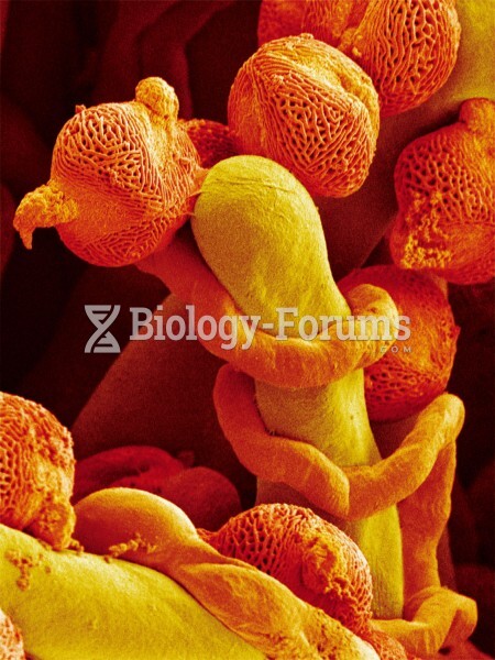 Pollen Tube Growth