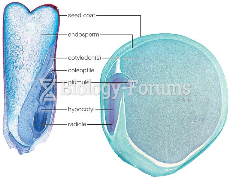 Anatomy of a seed. Left, corn (Zea Mays), a monocot; right, pea (Pisum sativum), a eudicot