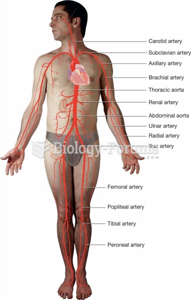 Arteries in the body.