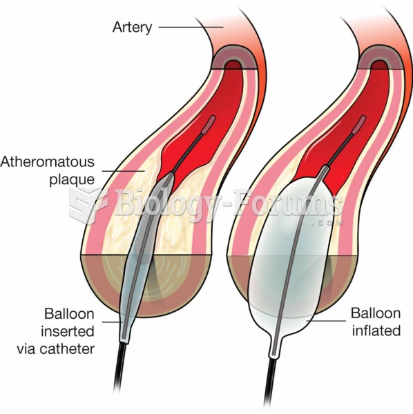 Balloon angioplasty.