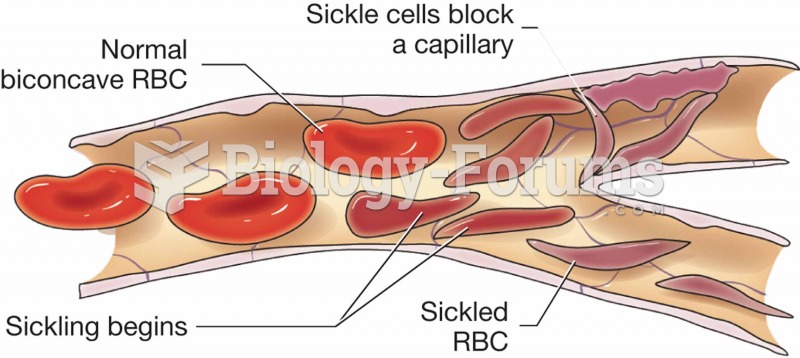 Sickle cells in a ¬capillary.