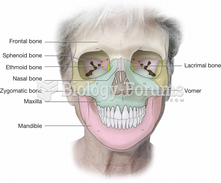 Front view of the cranium and facial bones.