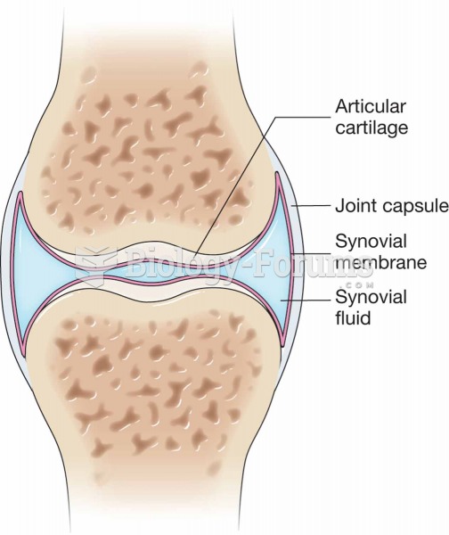 Synovial joint.