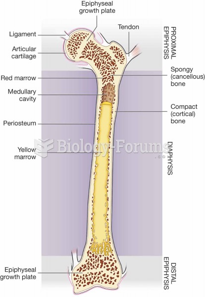 Structure of a bone.