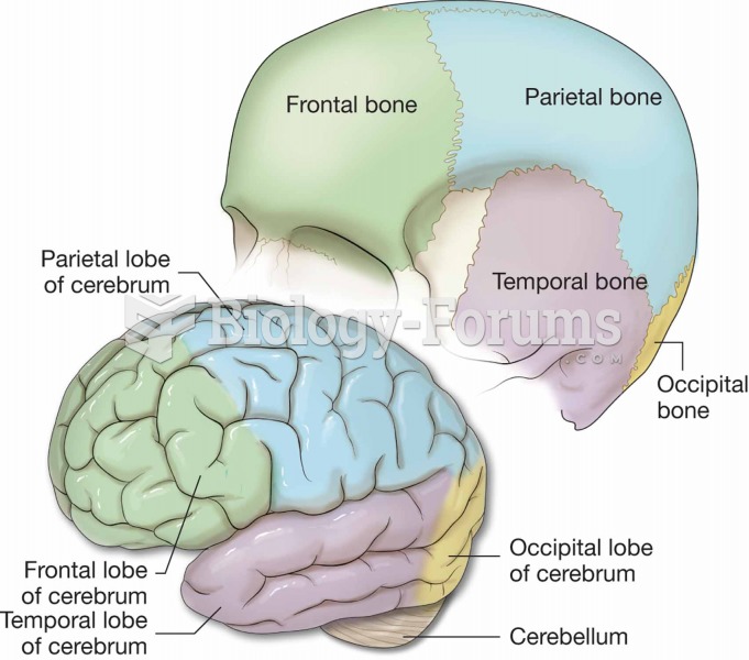Lobes of the cerebrum.