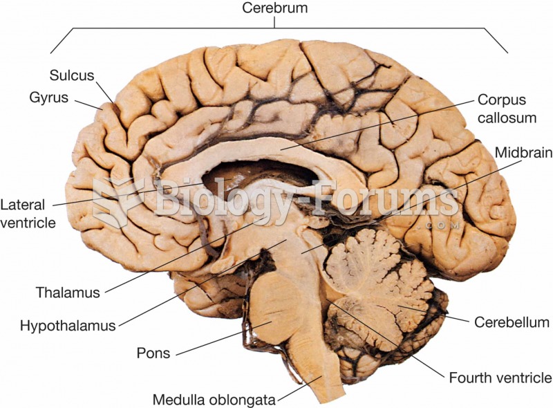 Midline cut section of the brain.