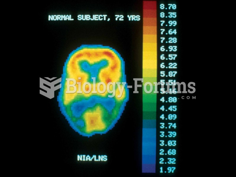 PET scan of a normal brain.