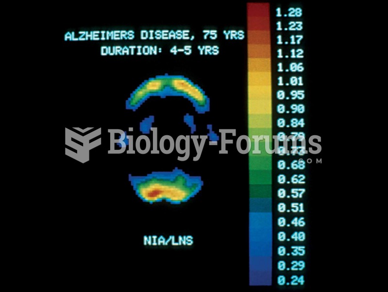 PET scan of the brain in a patient with Alzheimer’s disease.