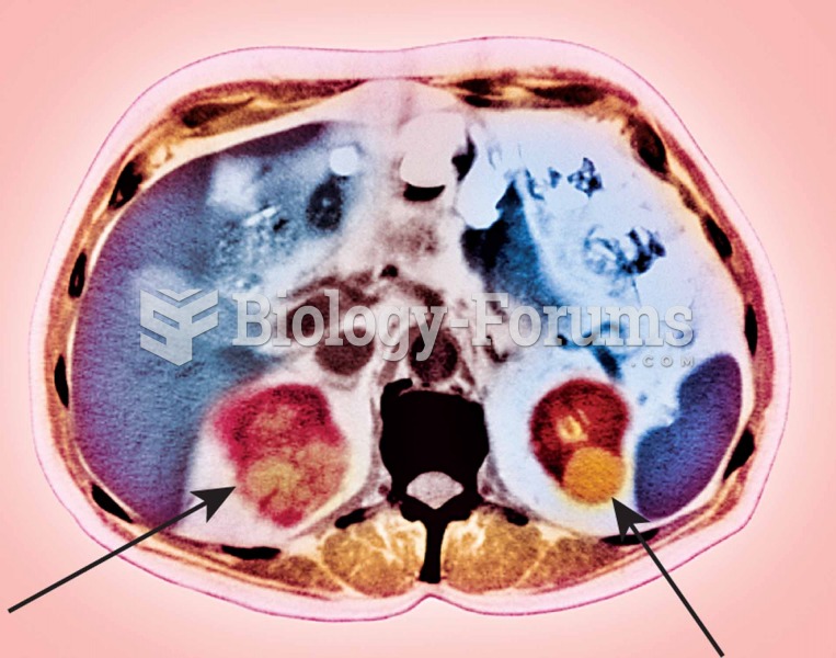 CT scan of the kidneys.