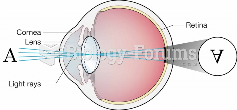 Light rays coming from an object to the retina.