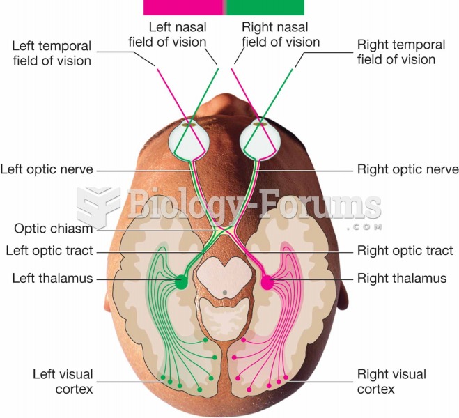Optic nerve, optic chiasm, ¬thalamus, and visual cortex.
