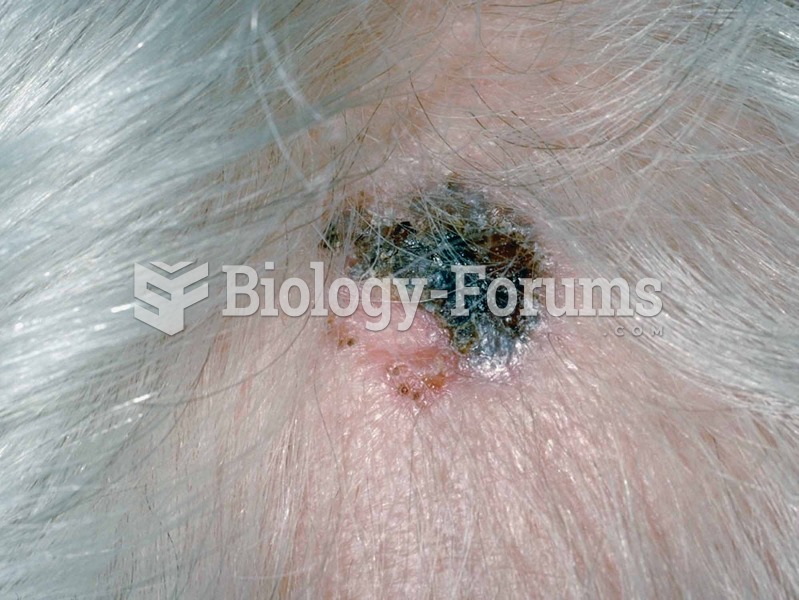 Basal cell carcinoma.