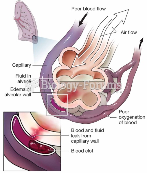 Adult respiratory distress syndrome