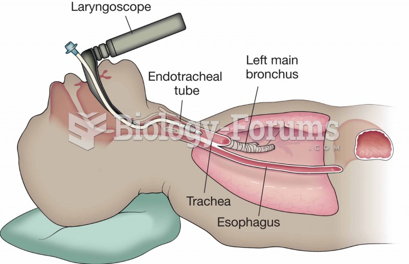 Endotracheal intubation