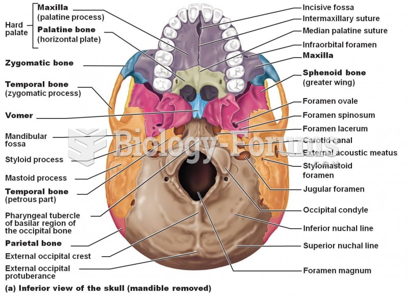 Skull Inferior View Labeled