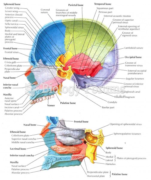 Skull Midsagittal Section Labeled