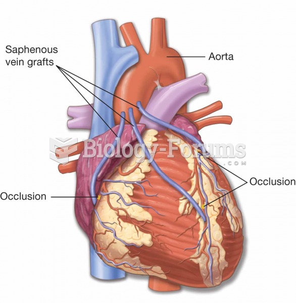 A coronary artery bypass graft (CABG) is a procedure to bypass a blocked coronary artery. The proced