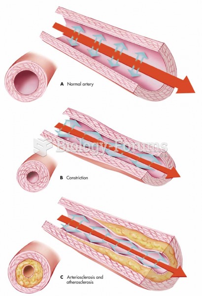Blood vessels: (A) normal artery, (B) constriction, and (C) arteriosclerosis and atherosclerosis.