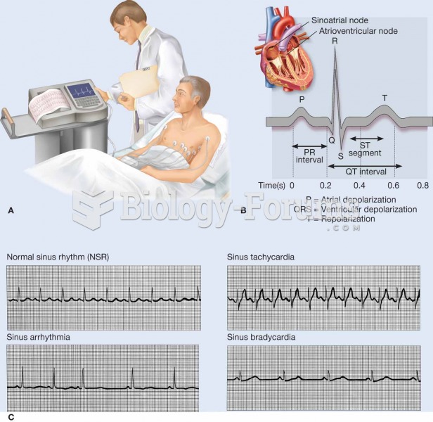 An electrocardiogram (ECG, EKG) is a commonly used procedure in which the electrical events associat