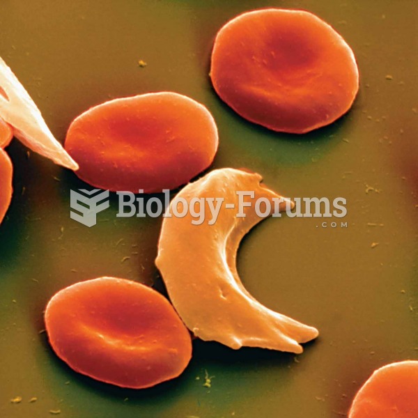 Iron deficiency anemia blood cells. 