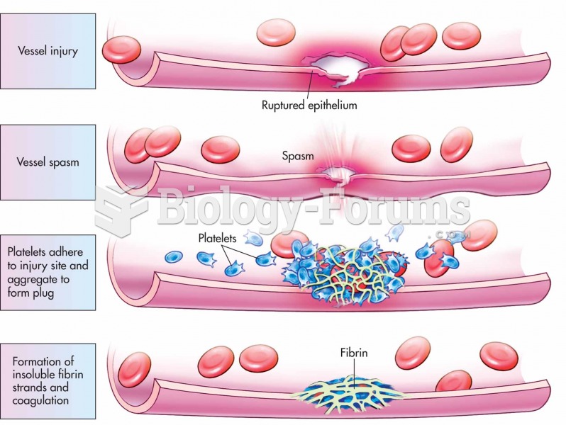 Basic steps in hemostasis.