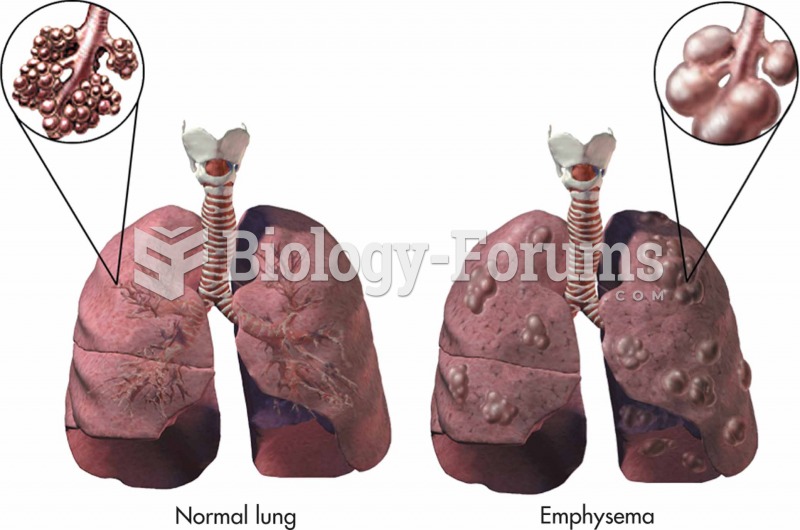 Normal lung and one with emphysema.
